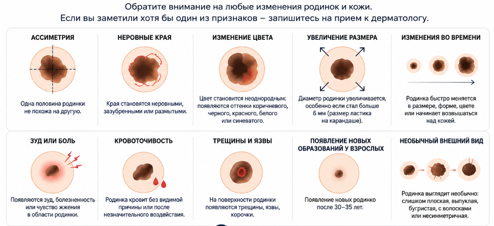 проверить родинки как проверить родинки